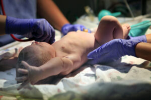 Birth Injury Lawyer Miami FL with a newborn baby