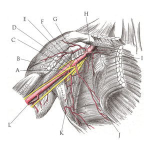 Miami Florida Brachial Plexus Malpractice Lawyer 