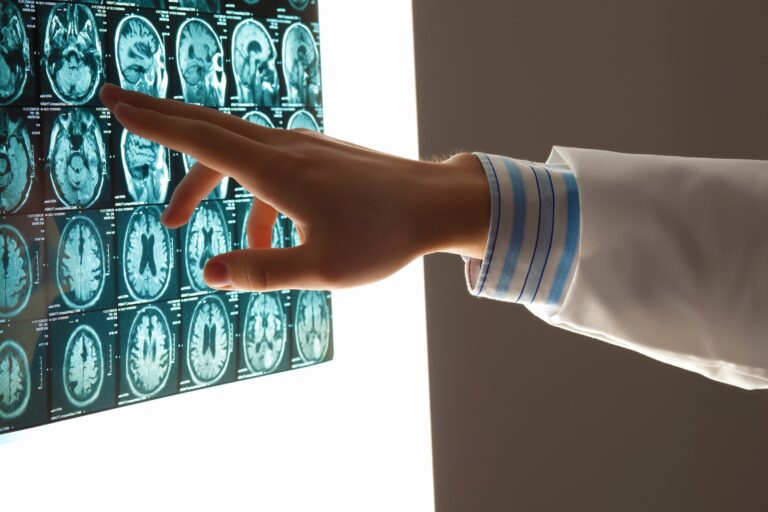 brain injury lawyer Fort Lauderdale, FL
